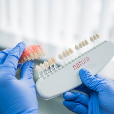 Composite Bonding and Veneers